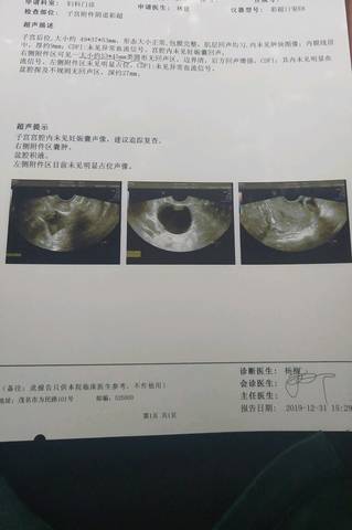 子宫前位会影响借卵做试管婴儿的成功率吗？