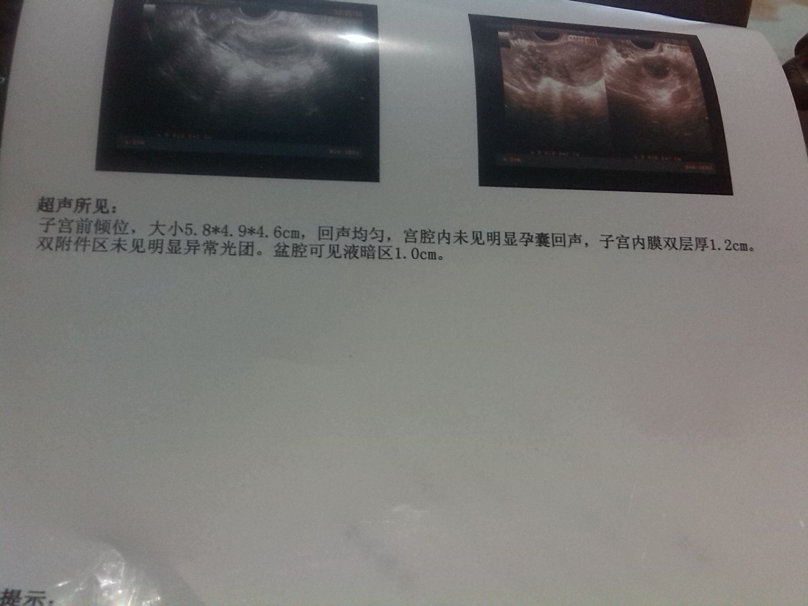 两次自然受孕出现胎停育，能否避免做供卵试管婴儿？